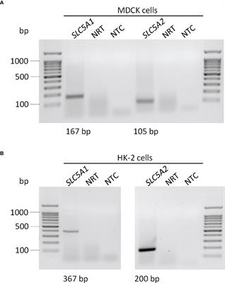 The impact of SGLT2 inhibitors on αKlotho in renal MDCK and HK-2 cells